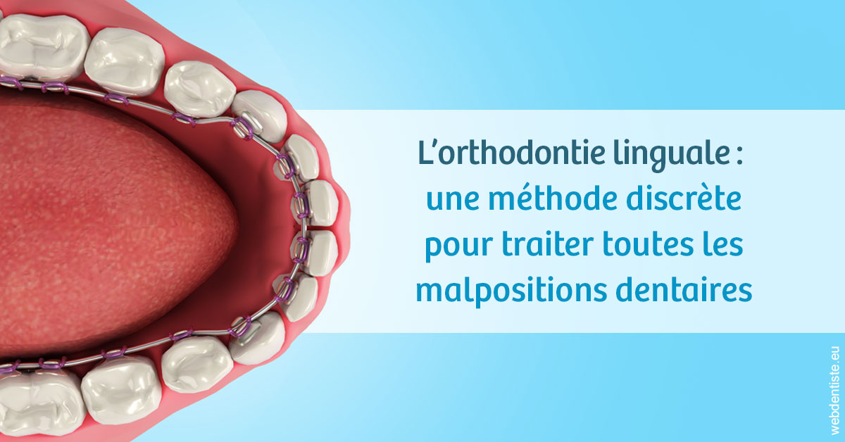 https://selarl-ms-dentaire.chirurgiens-dentistes.fr/L'orthodontie linguale 1