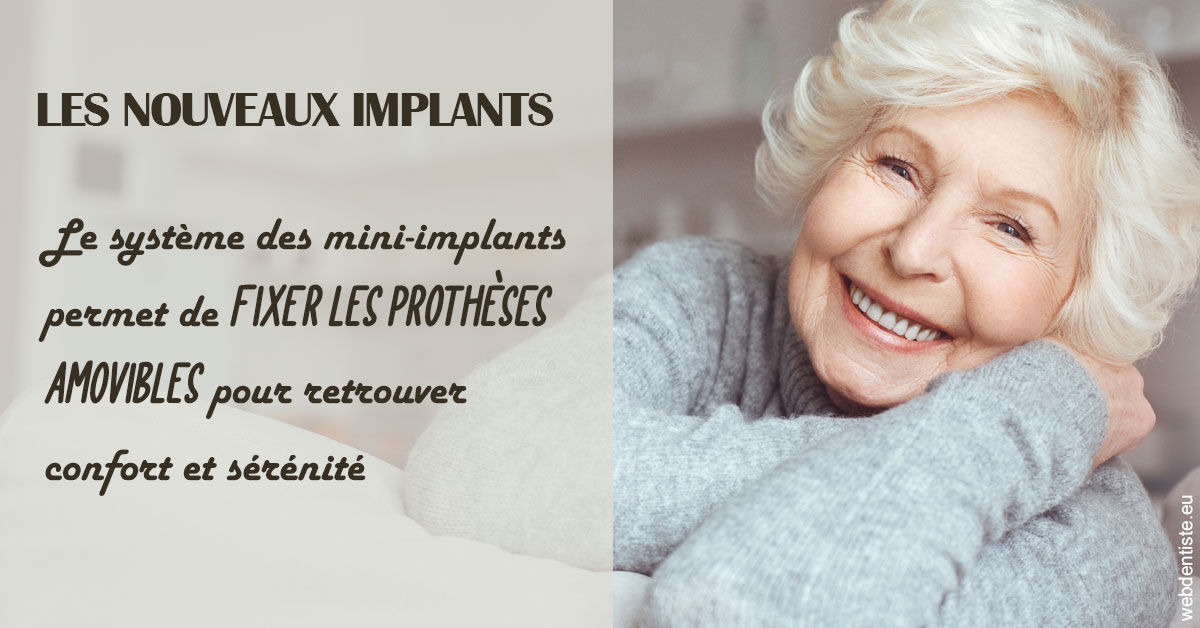 https://selarl-ms-dentaire.chirurgiens-dentistes.fr/Les nouveaux implants 1