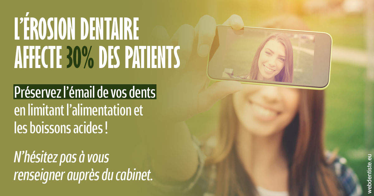 https://selarl-ms-dentaire.chirurgiens-dentistes.fr/L'érosion dentaire 1