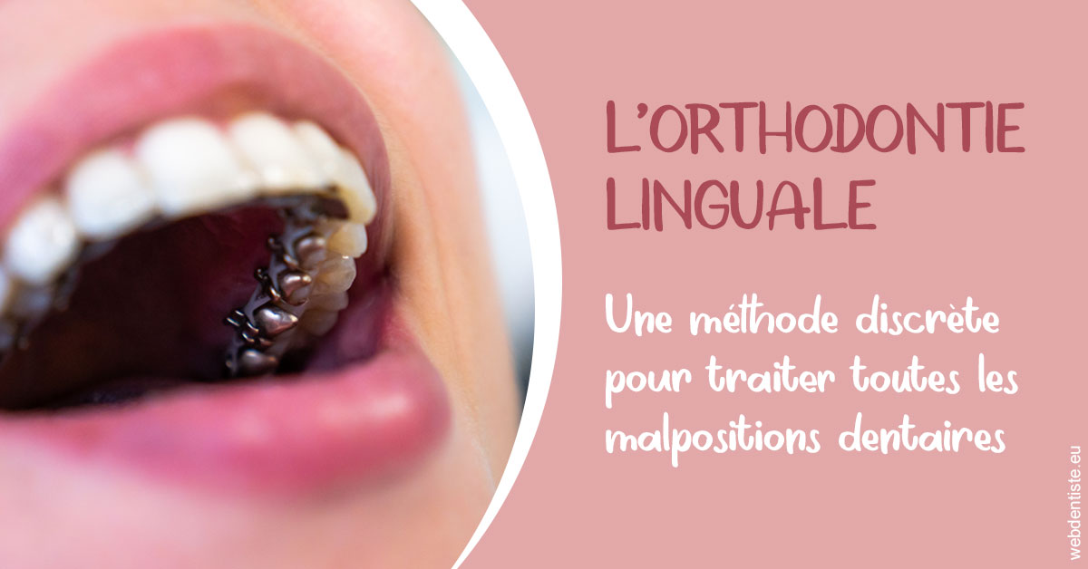 https://selarl-ms-dentaire.chirurgiens-dentistes.fr/L'orthodontie linguale 2