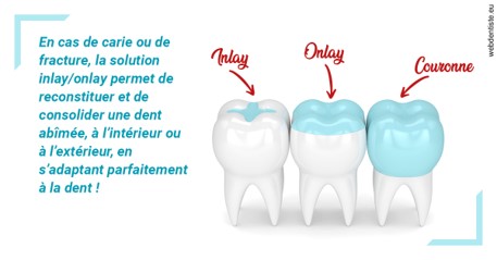 https://selarl-ms-dentaire.chirurgiens-dentistes.fr/L'INLAY ou l'ONLAY