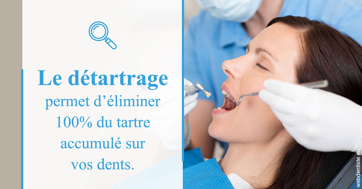 https://selarl-ms-dentaire.chirurgiens-dentistes.fr/En quoi consiste le détartrage