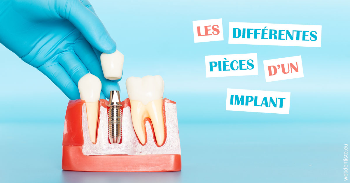 https://selarl-ms-dentaire.chirurgiens-dentistes.fr/Les différentes pièces d’un implant 2