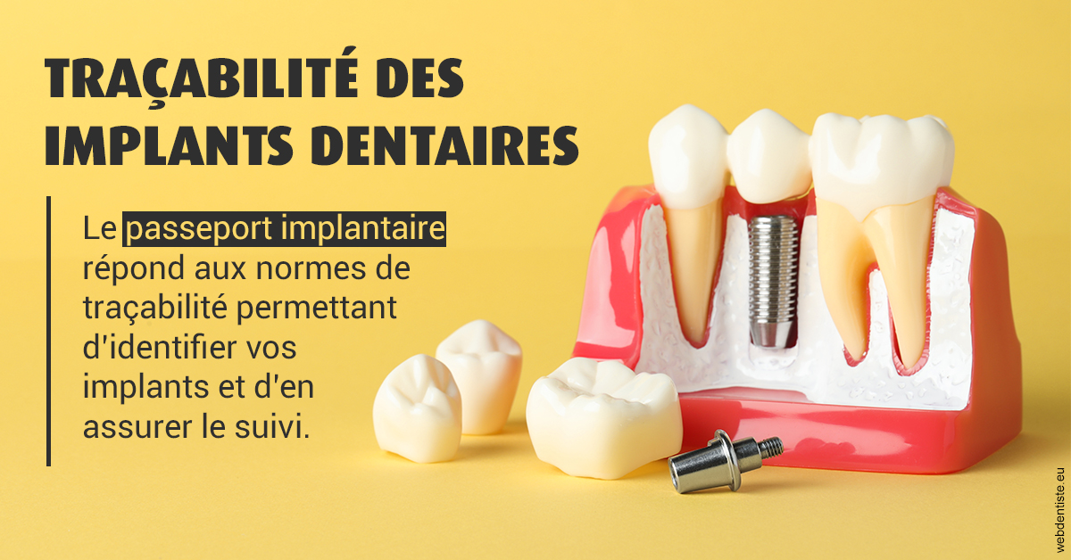 https://selarl-ms-dentaire.chirurgiens-dentistes.fr/T2 2023 - Traçabilité des implants 2