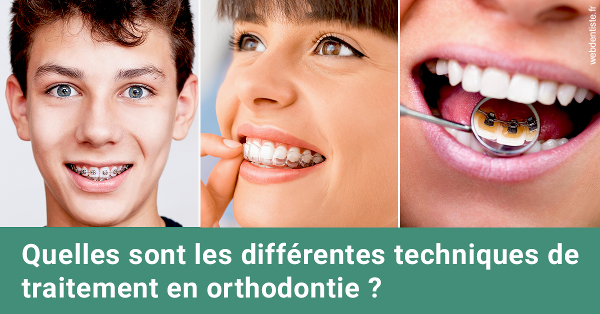 https://selarl-ms-dentaire.chirurgiens-dentistes.fr/Les différentes techniques de traitement 2