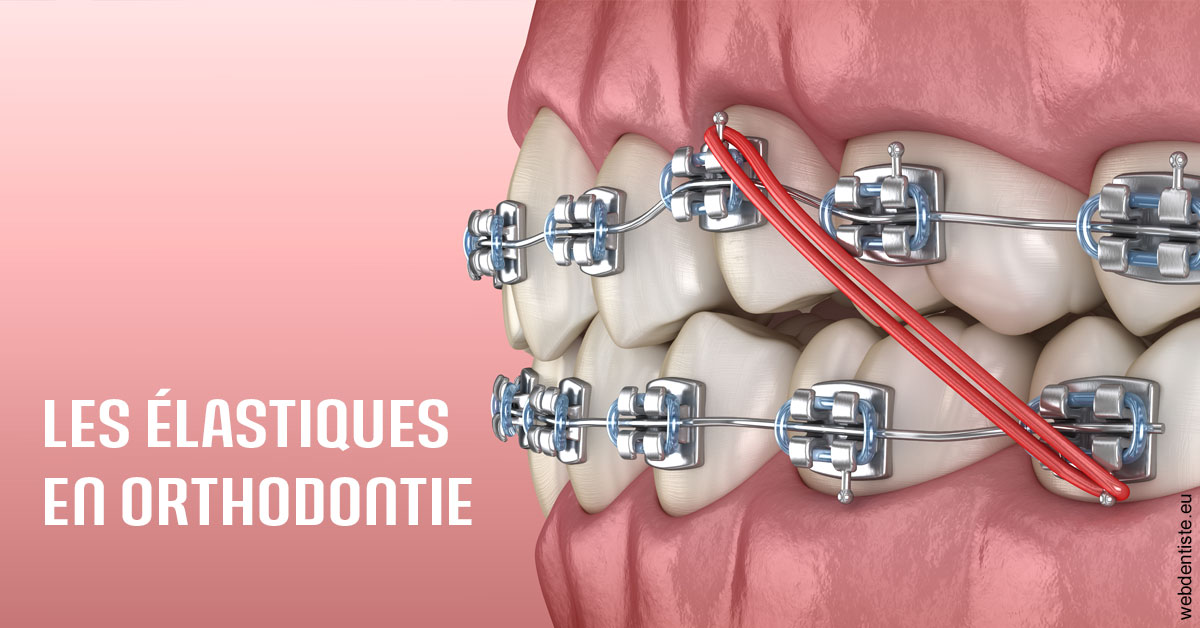 https://selarl-ms-dentaire.chirurgiens-dentistes.fr/Elastiques orthodontie 2