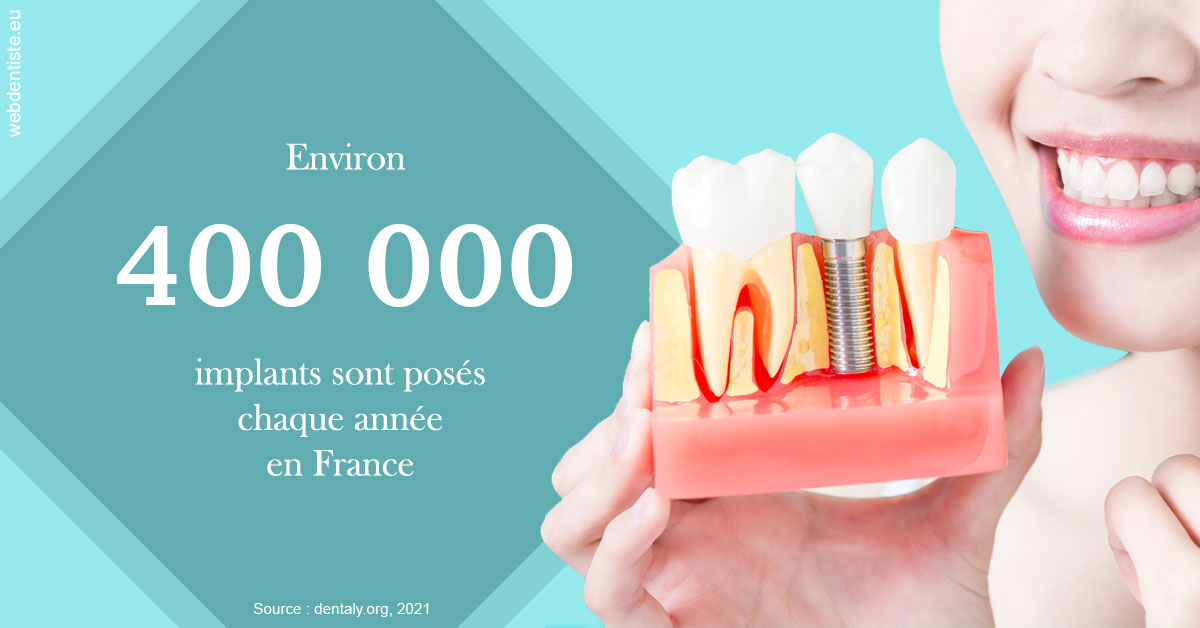 https://selarl-ms-dentaire.chirurgiens-dentistes.fr/Pose d'implants en France 2