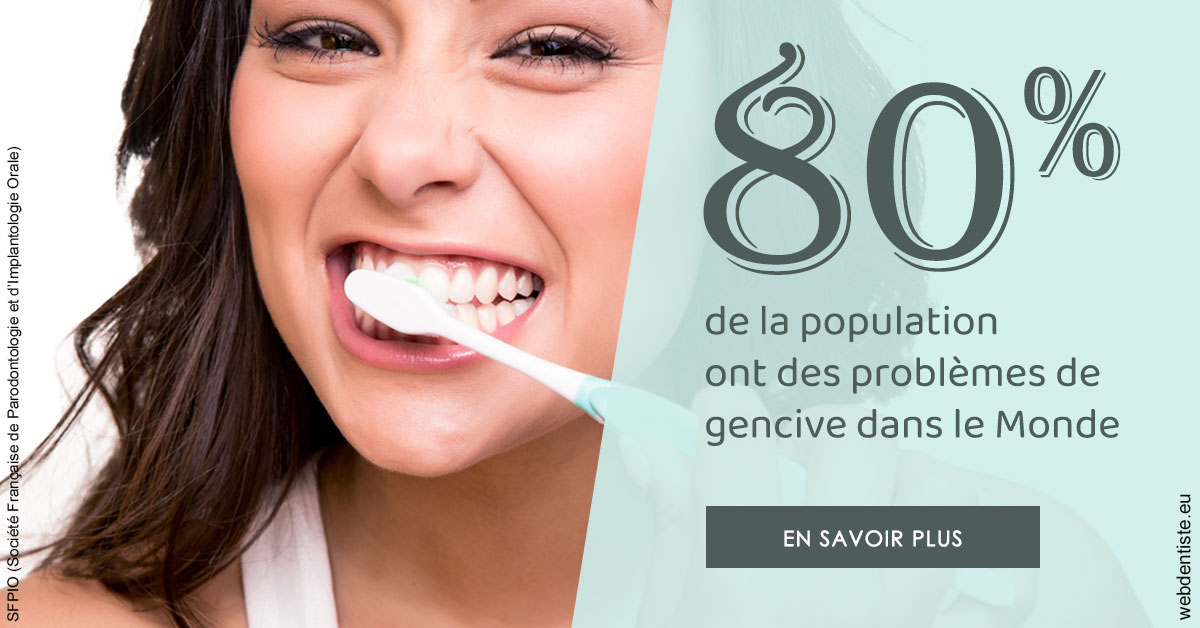 https://selarl-ms-dentaire.chirurgiens-dentistes.fr/Problèmes de gencive 1
